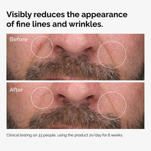 Before and After showing how 100% Fermented Rose Hip Seed Oil reduces fine lines and wrinkles